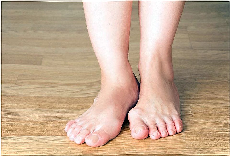 5 tips to prevent the appearance of bunions