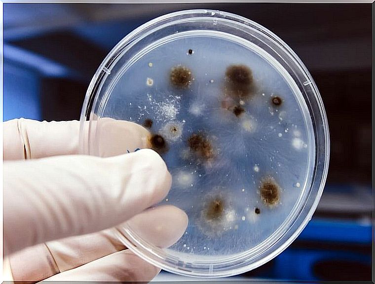 General aspects of cryptococcosis