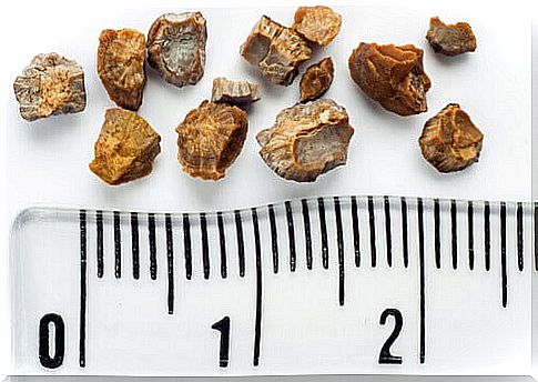 kidney stones