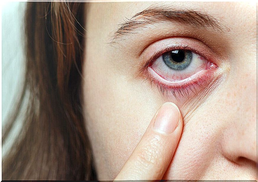 What are ocular migraines?