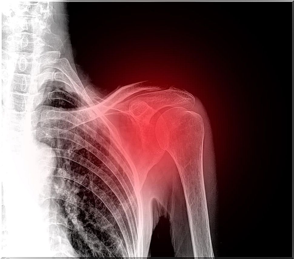 Shoulder pain