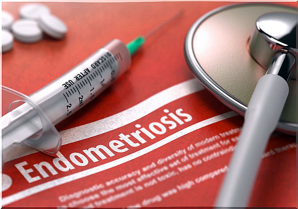 Surgical treatment of endometriosis