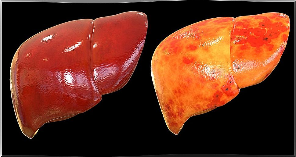 Orlistat and Rimonabant