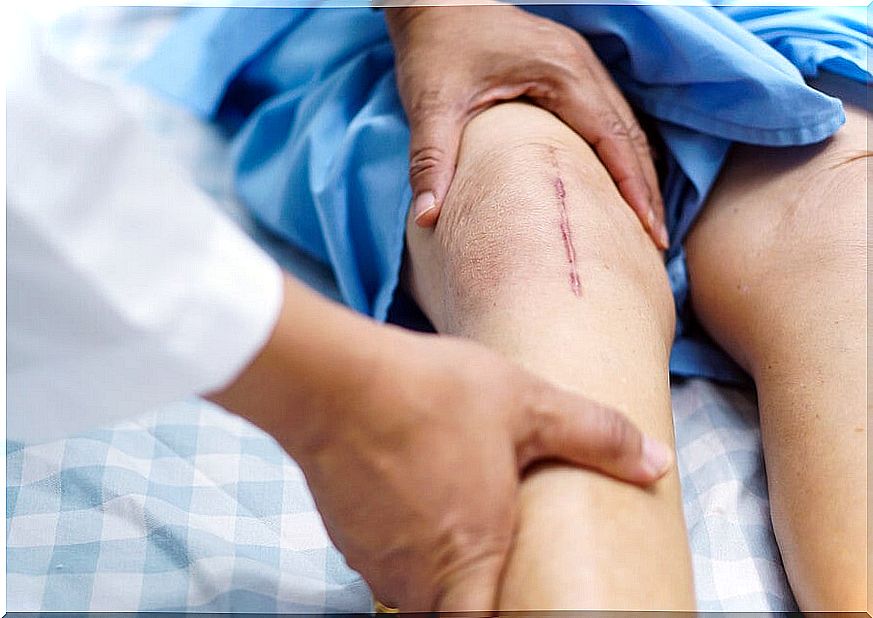 Doctor evaluating a recently operated knee