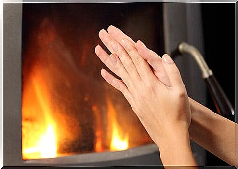 Scleroderma can be associated with Raynaud's syndrome